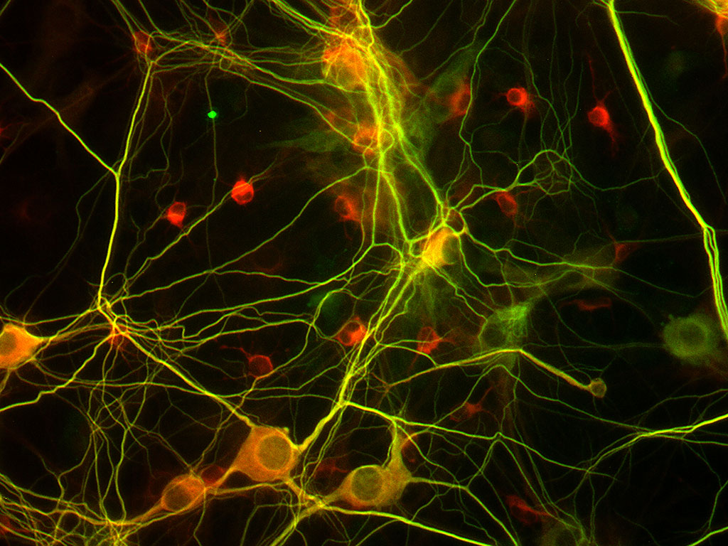 Hippocampal Neuron