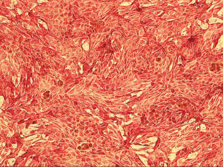RPTEC - Human Renal Proximal Tubule Epithelial Cells