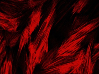 UtSMC – Human Uterine Smooth Muscle Cells