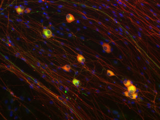 Rat Embryonic Dorsal Root Ganglion (eDRG) Neurons