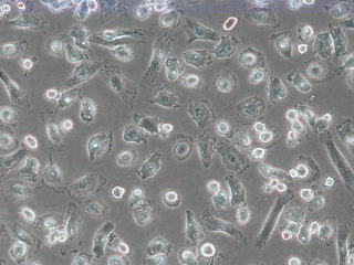 Human Peripheral Blood CD14+ Monocytes, Cryopreserved, Positive Selection, 20 million