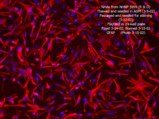 NHA – Human Astrocytes