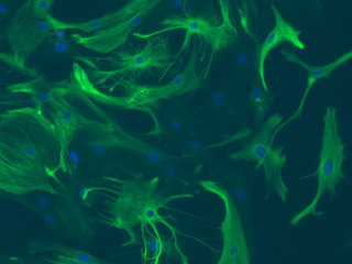 Mouse C57 Mixed Astrocytes