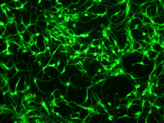Mouse C57 Brain Striatum Neurons