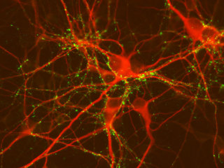 Mouse CD1 Brain Striatum Neurons