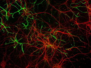 Mouse C57 Brain Cortex Neurons