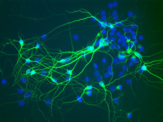 Mouse CD1 Brain Cortex Neurons