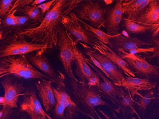 Irradiated Mouse Embryonic Fibroblasts (iMEF)