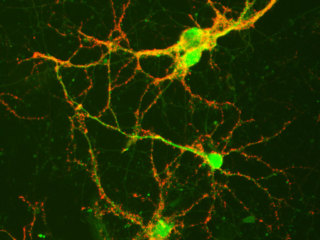 Mouse Hippocampal Neurons
