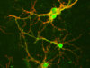 Mouse Hippocampal Neurons