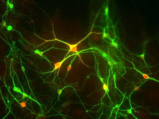 Rat Brain Striatum Neurons