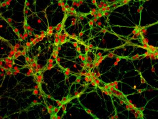 Rat Cerebellar Granular Neurons