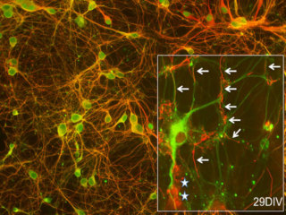 Rat Brain Cortex Neurons