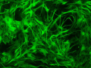 Rat Brain Cortex Astro. amp, 1 mil cells
