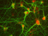 Rat Brain HC Neurons cyro amp, 1M cells