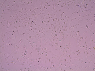 Stellate Cells, Human Cryopreserved, 0.2 Million Cells