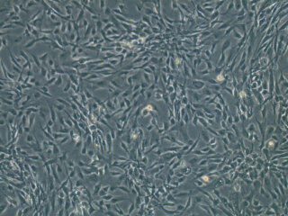 Human Liver-Derived Endothelial Cells P1