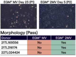 EGM<sup>TM</sup> -2 MV Microvascular Endothelial Cell Growth Medium-2 BulletKit<sup>TM</sup>