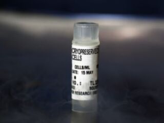 NHDF-Ad-Der Fibroblasts FGM-2, cryo amp