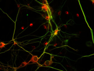 Rat Brain Hippocampus Neurons